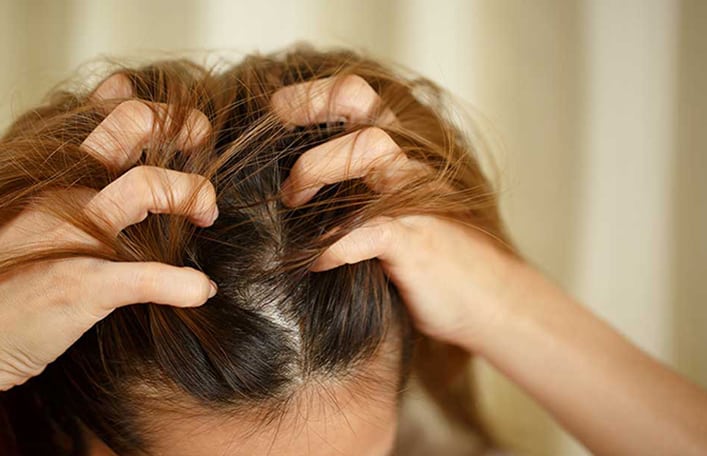 Na zdjęciu widoczny czubek głowy kobiety oraz jej dłonie wsunięte we włosy. Zdjęcie ma zwrócić uwagę na skórę głowy. Wąski kadr. 